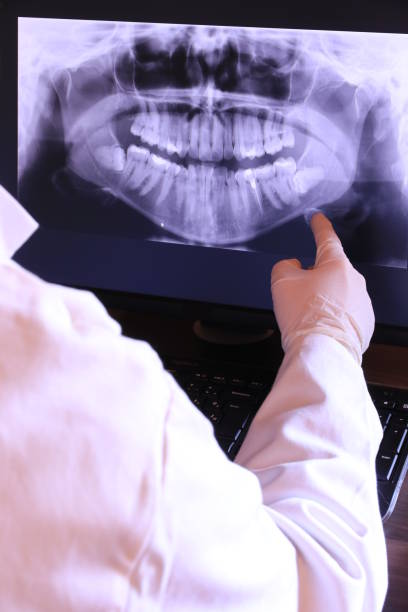 Best Emergency Dental Care for Abscessed Tooth in Mbrian Park, CA