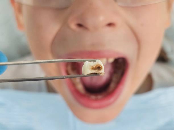 Best Urgent Dental Care for Toothache in Mbrian Park, CA