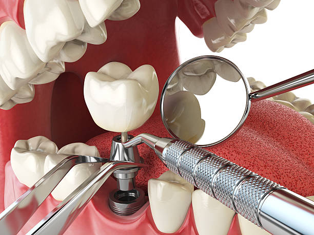 Best Emergency Dental Services for Seniors in Mbrian Park, CA