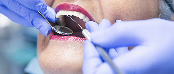Best Mobile Emergency Dentist in Mbrian Park, CA